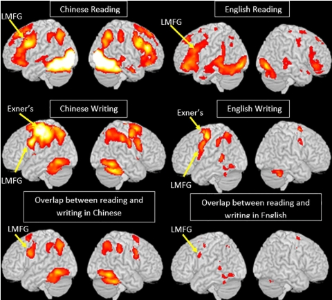 Brain activation during language processing